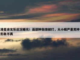 港星余文乐近况曝光！面部肿胀像被打，大小眼严重男神形象不再